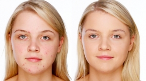 أسرار من خبراء التجميل: كيف تخفين الشوائب والبقع السوداء من وجهك بدقائق؟
