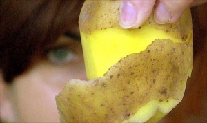  قشرة البطاطس قد تصيبك بالتسمم